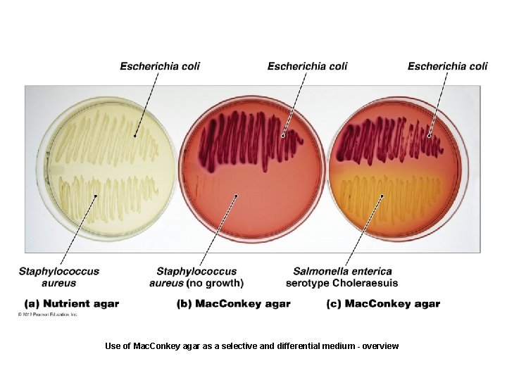 Use of Mac. Conkey agar as a selective and differential medium - overview 