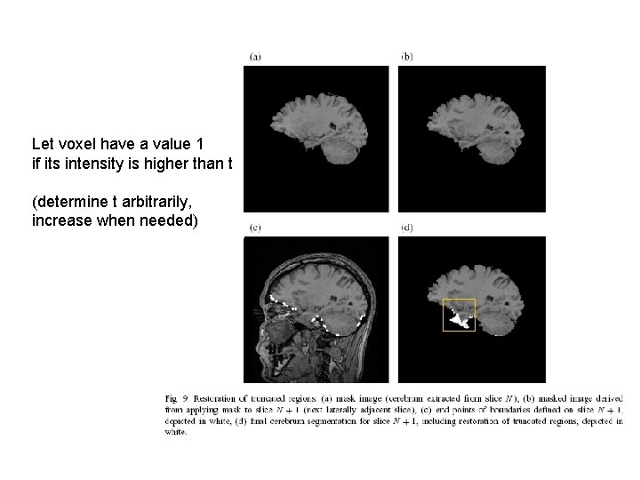 Let voxel have a value 1 if its intensity is higher than t (determine