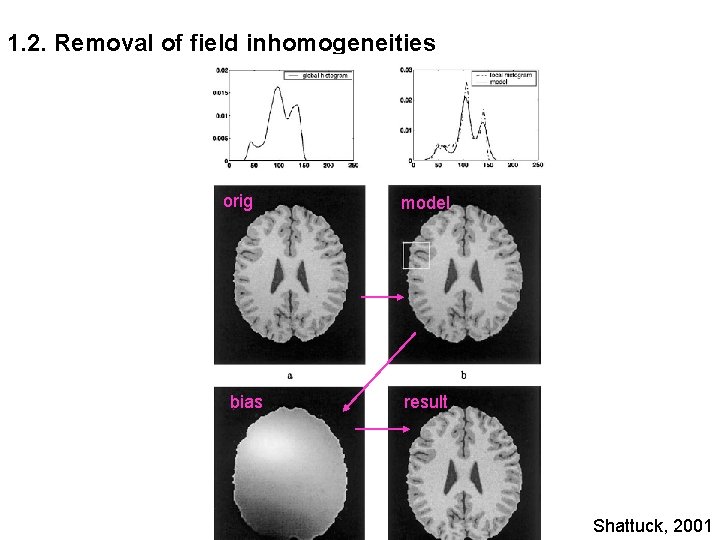 1. 2. Removal of field inhomogeneities orig bias model result Shattuck, 2001 