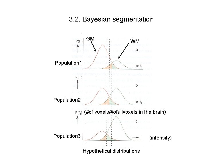 3. 2. Bayesian segmentation GM WM Population 1 Population 2 (#of voxels/#ofallvoxels in the