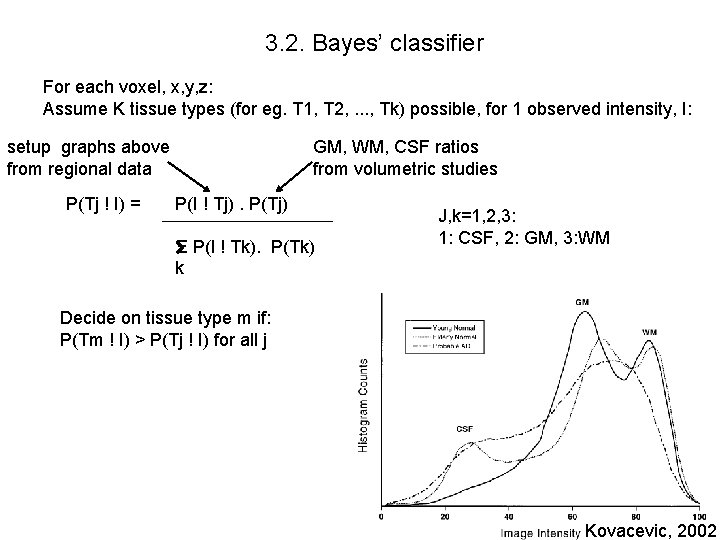 3. 2. Bayes’ classifier For each voxel, x, y, z: Assume K tissue types