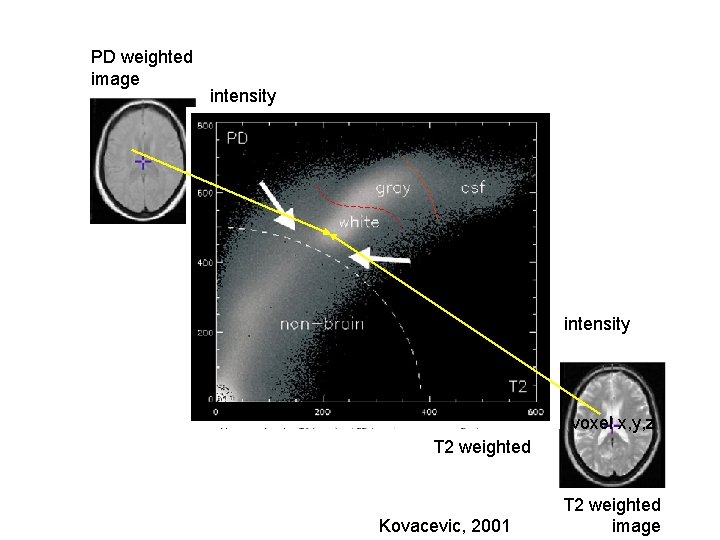 PD weighted image intensity voxel x, y, z T 2 weighted Kovacevic, 2001 T