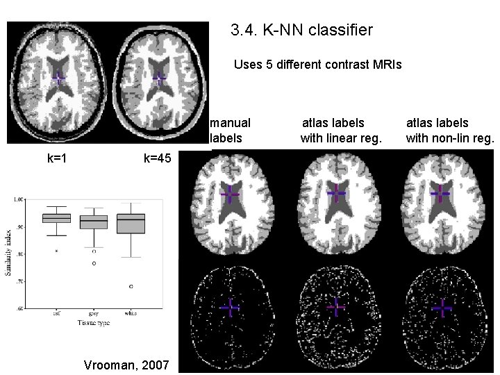 3. 4. K-NN classifier Uses 5 different contrast MRIs manual labels k=1 k=45 Vrooman,