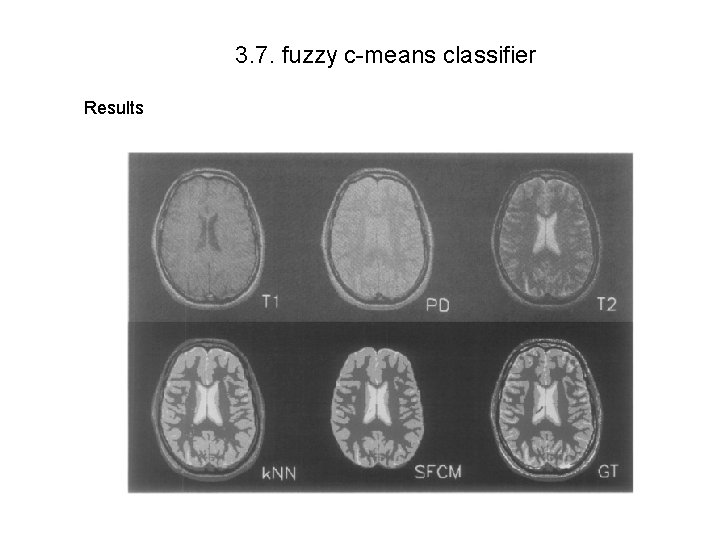 3. 7. fuzzy c-means classifier Results 