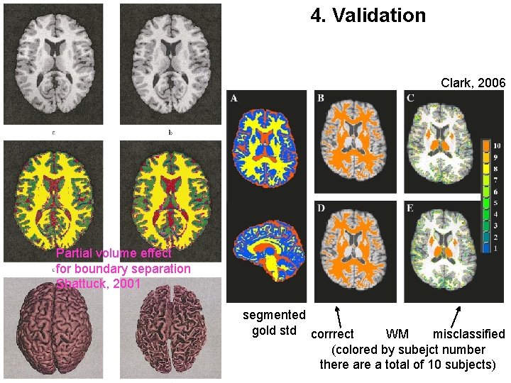 4. Validation Clark, 2006 Partial volume effect for boundary separation Shattuck, 2001 segmented gold