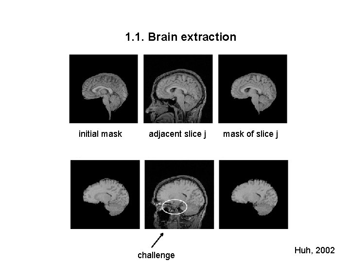 1. 1. Brain extraction initial mask adjacent slice j challenge mask of slice j