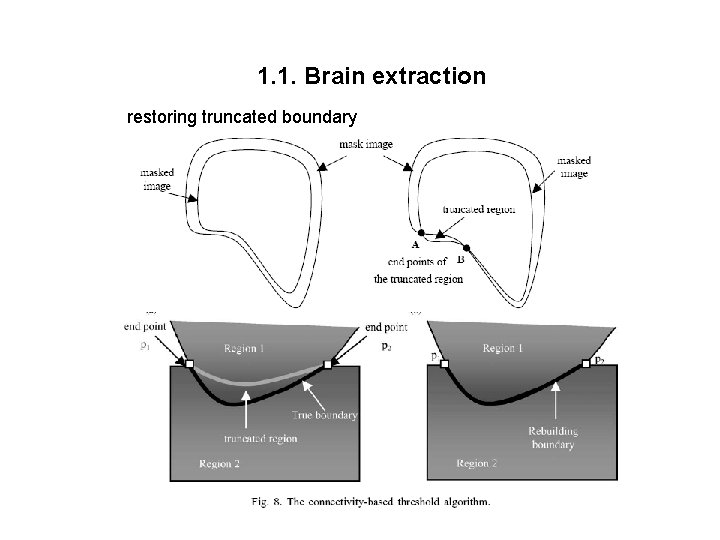 1. 1. Brain extraction restoring truncated boundary 
