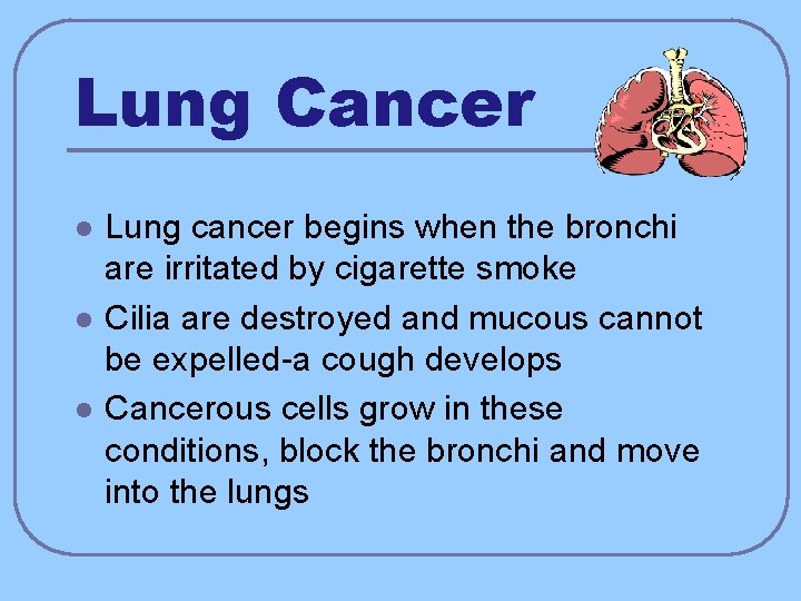 Lung Cancer l l l Lung cancer begins when the bronchi are irritated by