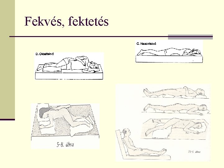 Fekvés, fektetés 