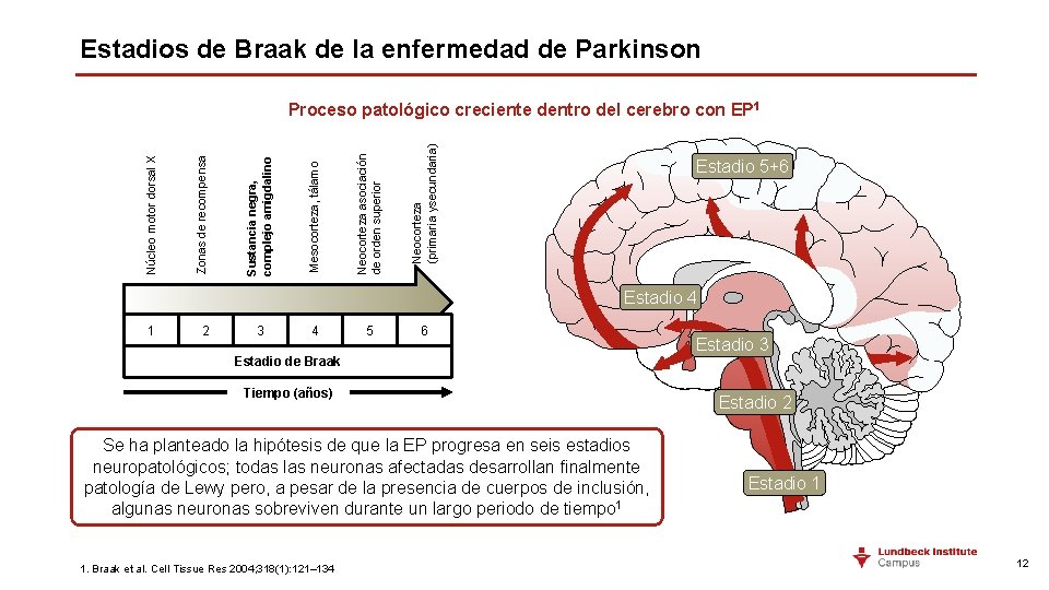 Estadios de Braak de la enfermedad de Parkinson Neocorteza (primaria ysecundaria) Neocorteza asociación de