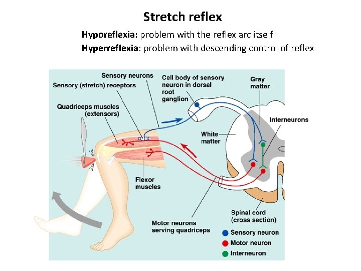 Stretch reflex Hyporeflexia: problem with the reflex arc itself Hyperreflexia: problem with descending control
