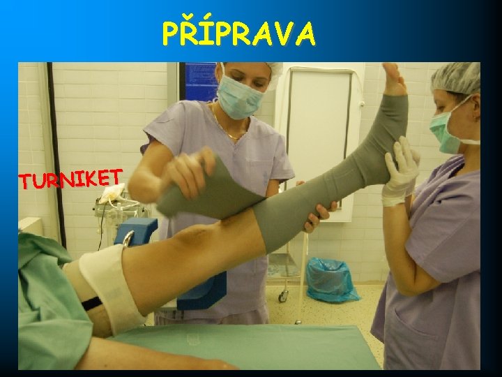 PŘÍPRAVA TURNIKET 