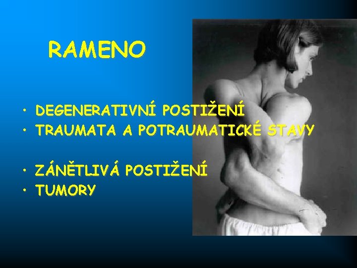 RAMENO • DEGENERATIVNÍ POSTIŽENÍ • TRAUMATA A POTRAUMATICKÉ STAVY • ZÁNĚTLIVÁ POSTIŽENÍ • TUMORY