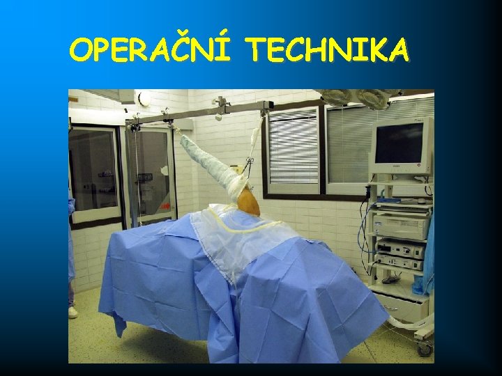 OPERAČNÍ TECHNIKA 