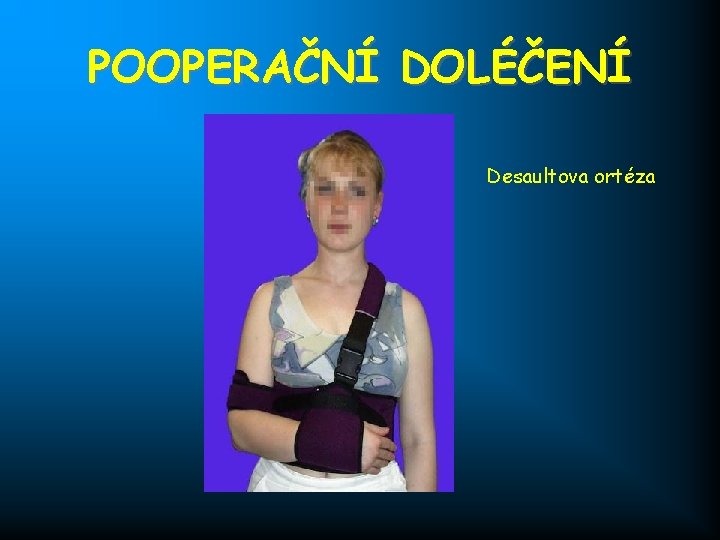 POOPERAČNÍ DOLÉČENÍ Desaultova ortéza 