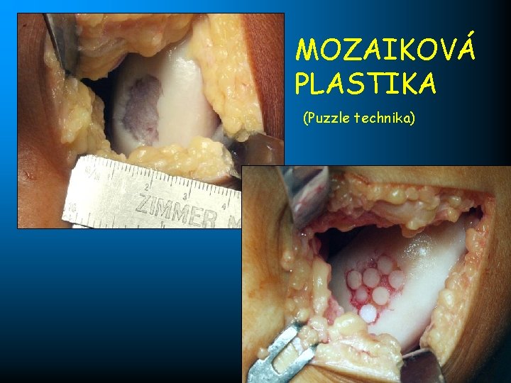 MOZAIKOVÁ PLASTIKA (Puzzle technika) 