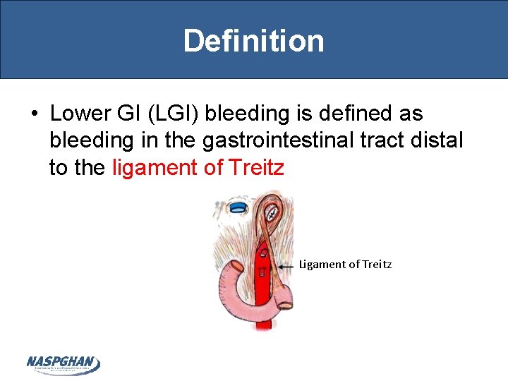 Definition • Lower GI (LGI) bleeding is defined as bleeding in the gastrointestinal tract