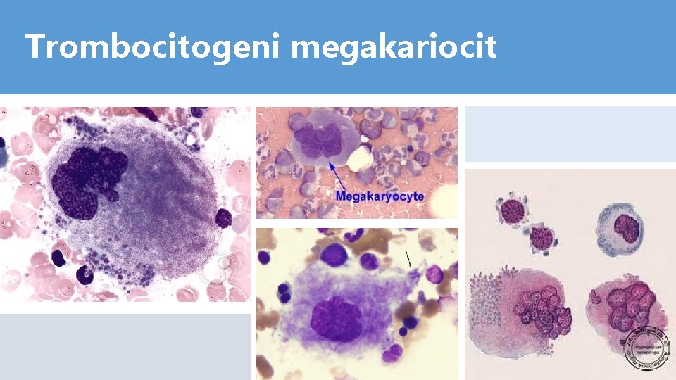 Trombocitogeni megakariocit 