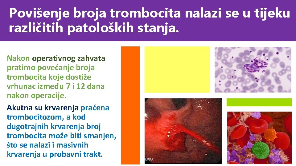 Povišenje broja trombocita nalazi se u tijeku različitih patoloških stanja. Nakon operativnog zahvata pratimo