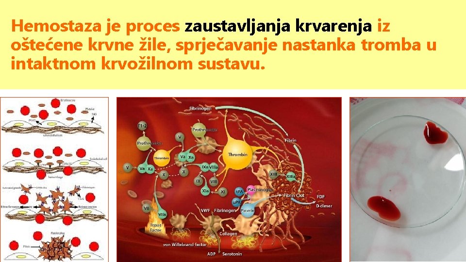 Hemostaza je proces zaustavljanja krvarenja iz oštećene krvne žile, sprječavanje nastanka tromba u intaktnom