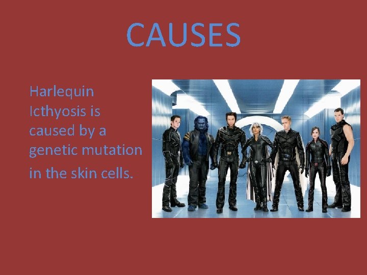 CAUSES Harlequin Icthyosis is caused by a genetic mutation in the skin cells. 
