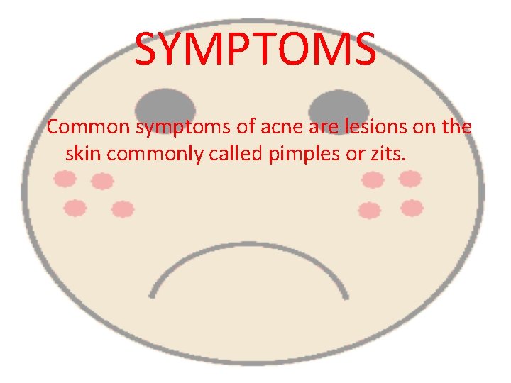 SYMPTOMS Common symptoms of acne are lesions on the skin commonly called pimples or