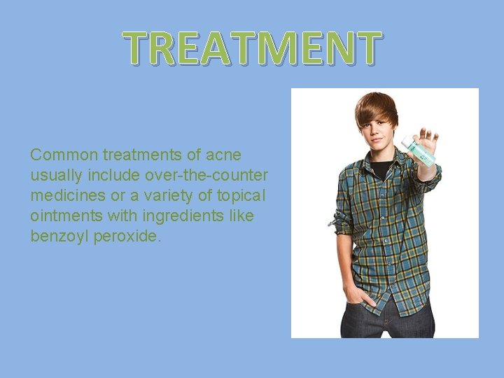 TREATMENT Common treatments of acne usually include over-the-counter medicines or a variety of topical