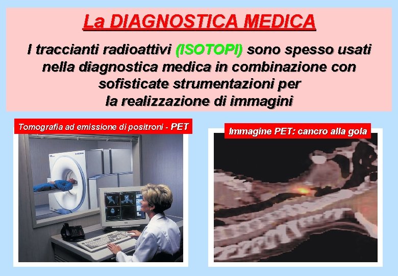 La DIAGNOSTICA MEDICA I traccianti radioattivi (ISOTOPI) sono spesso usati nella diagnostica medica in