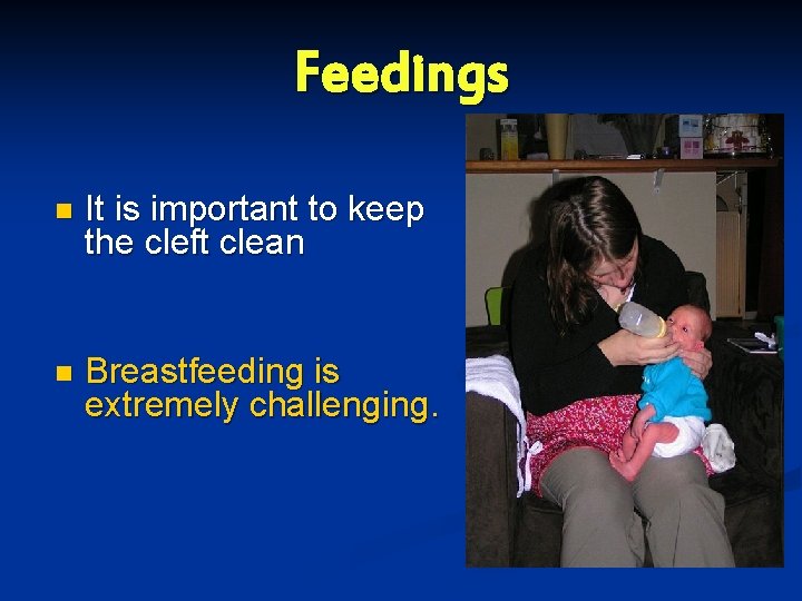 Feedings n It is important to keep the cleft clean n Breastfeeding is extremely