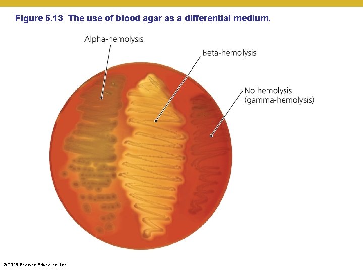 Figure 6. 13 The use of blood agar as a differential medium. © 2018