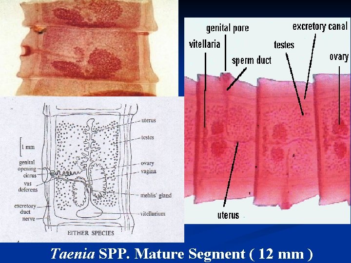 Taenia SPP. Mature Segment ( 12 mm ) 