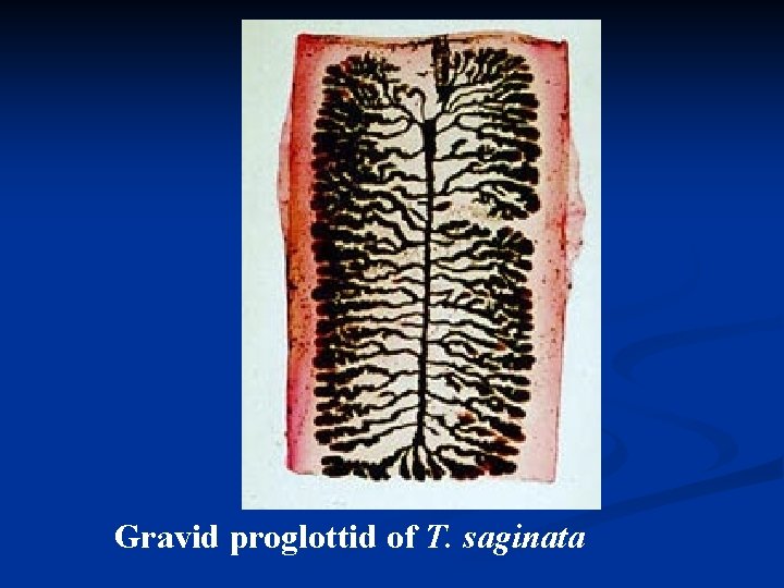 Gravid proglottid of T. saginata 