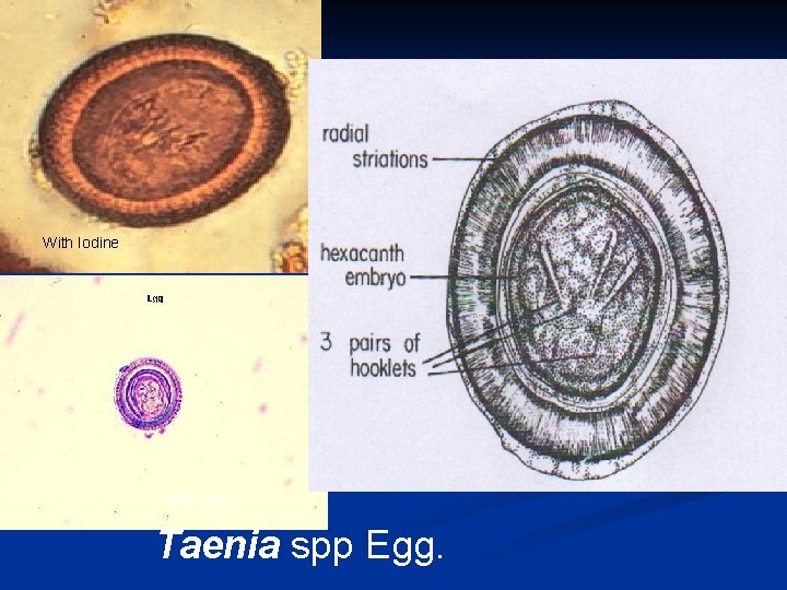 With Iodine With stain Taenia spp Egg. 