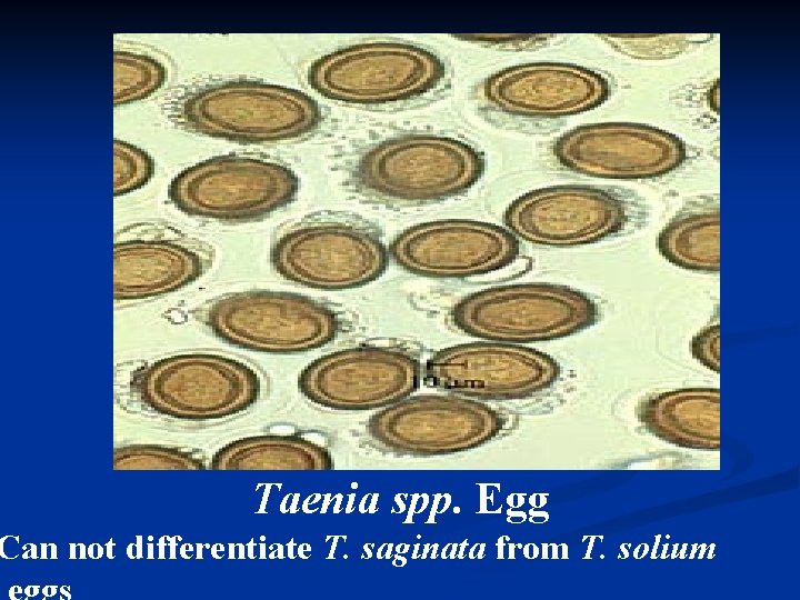 Taenia spp. Egg Can not differentiate T. saginata from T. solium 