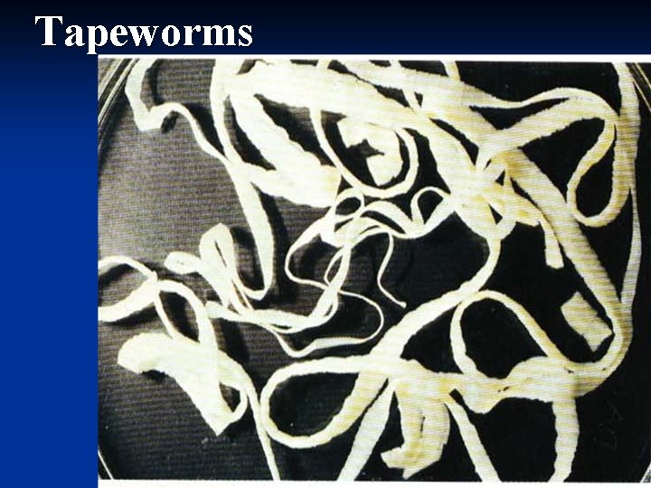 Tapeworms 