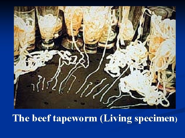 The beef tapeworm (Living specimen) 