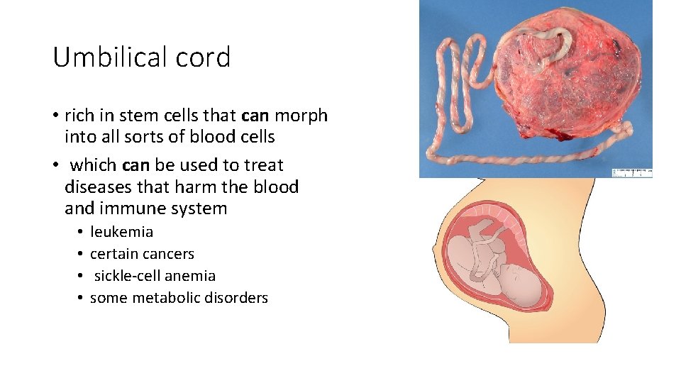 Umbilical cord • rich in stem cells that can morph into all sorts of