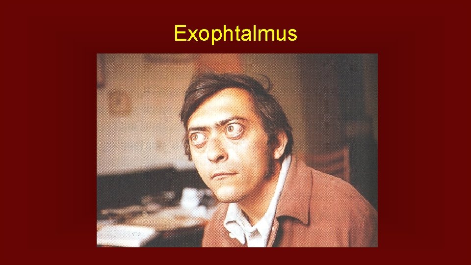 Exophtalmus 