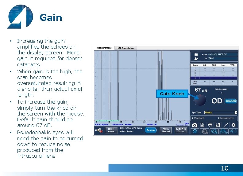 Gain • • Increasing the gain amplifies the echoes on the display screen. More