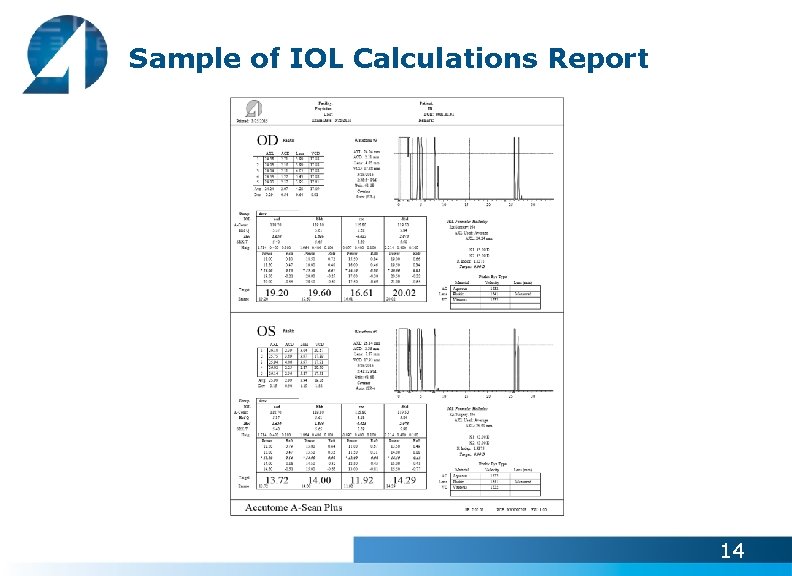 Sample of IOL Calculations Report 14 