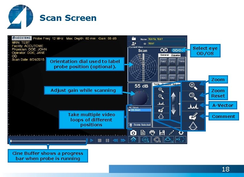 Scan Screen Select eye OD/OS Orientation dial used to label probe position (optional). Zoom
