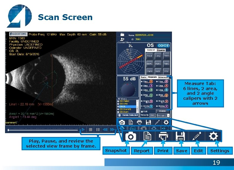 Scan Screen Measure Tab: 6 lines, 2 area, and 2 angle calipers with 2