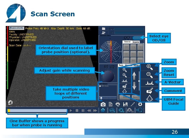 Scan Screen Select eye OD/OS Orientation dial used to label probe position (optional). Zoom