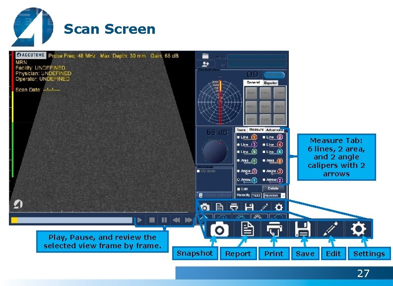 Scan Screen Measure Tab: 6 lines, 2 area, and 2 angle calipers with 2