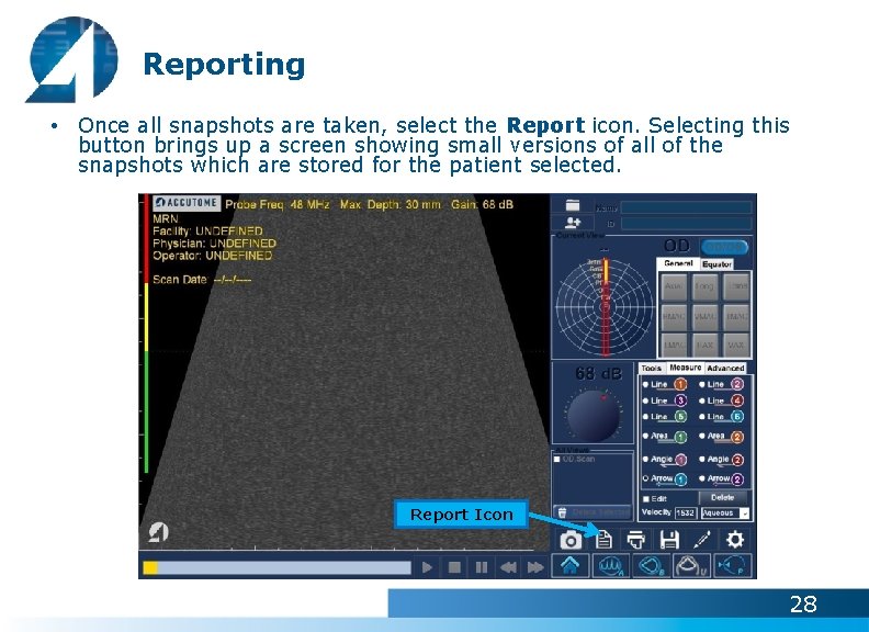 Reporting • Once all snapshots are taken, select the Report icon. Selecting this button