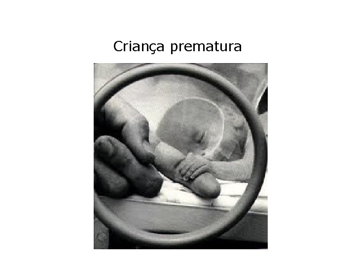 Criança prematura 