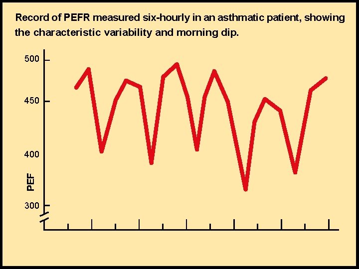 Record of PEFR measured six-hourly in an asthmatic patient, showing the characteristic variability and