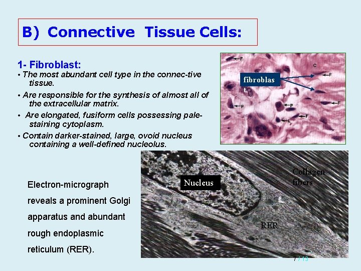 B) Connective Tissue Cells: 1 - Fibroblast: • The most abundant cell type in B) Connective Tissue Cells: 1 - Fibroblast: • The most abundant cell type in