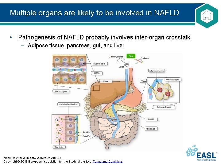 Multiple organs are likely to be involved in NAFLD • Pathogenesis of NAFLD probably