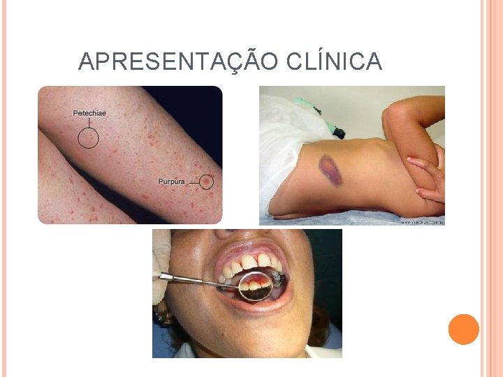 APRESENTAÇÃO CLÍNICA 